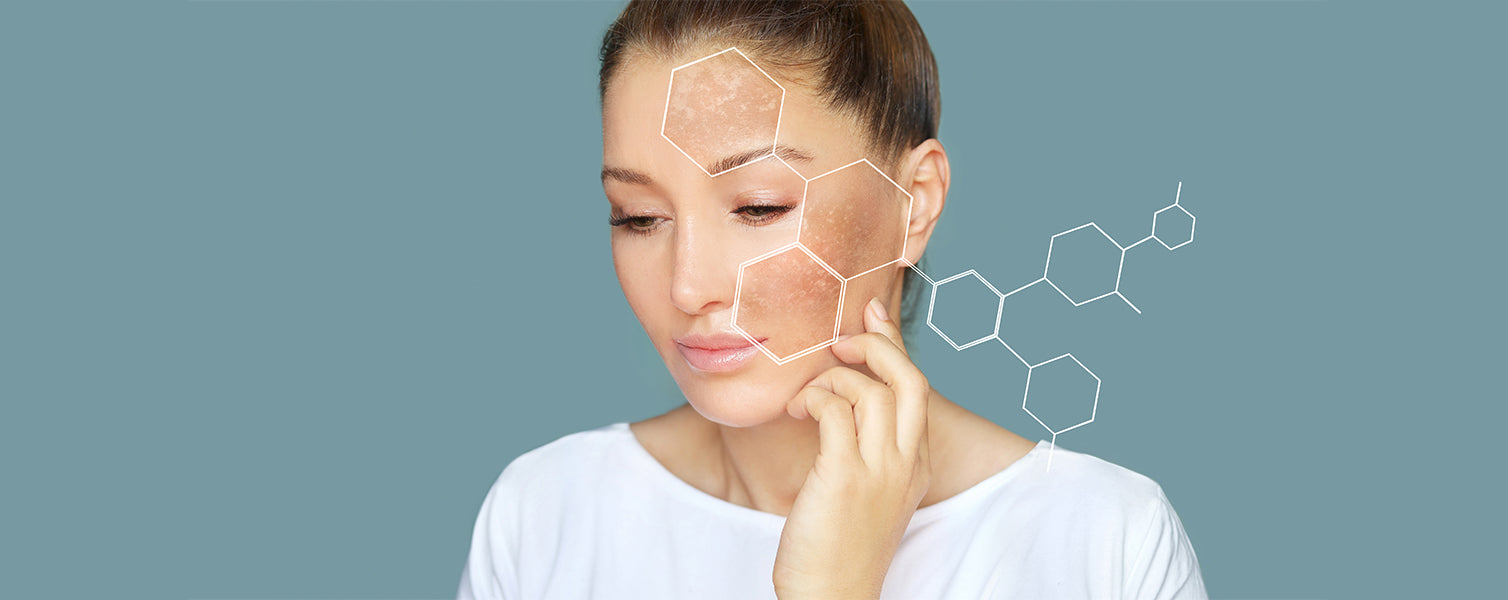 Top 5 Skincare Ingredients to Treat  Hyperpigmentation