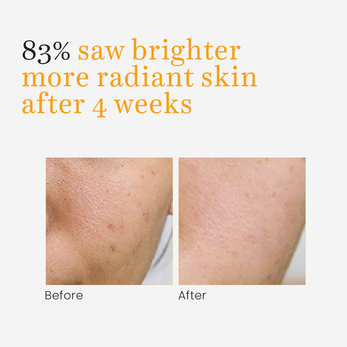 Vitamin-C Serum Glow for Dark Spots and Pigmentation (30ml)